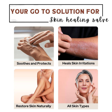 Skin healing Salve | Eczema, Psoriasis, Dry Skin with Calendula