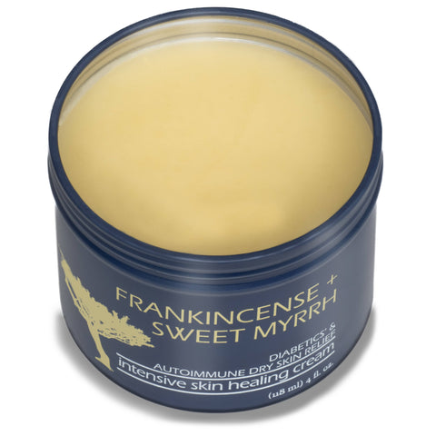 Frankincense & Sweet Myrrh Cream- Intensive Skin Healing 4oz